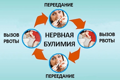 Лечение булимии в Лысьве